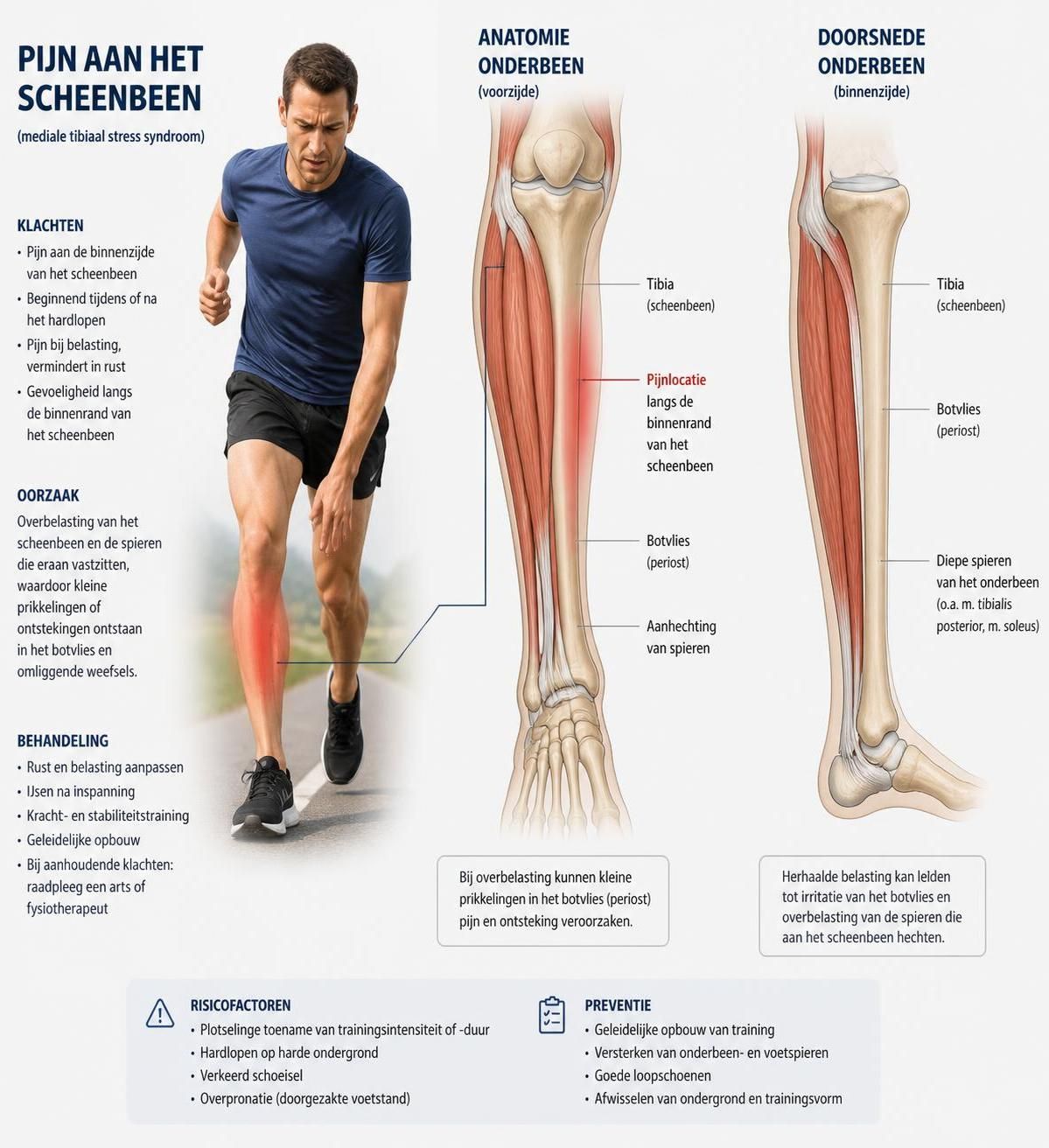 ontdek de oorzaken, symptomen en behandelingen van pijn aan het scheenbeen. leer hoe je scheenbeenspijn kunt herkennen en effectief kunt aanpakken.