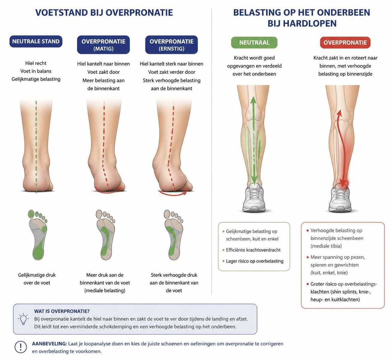 ontdek wat shin splints zijn, de symptomen en effectieve behandelmogelijkheden om pijn te verlichten en herstel te bevorderen.