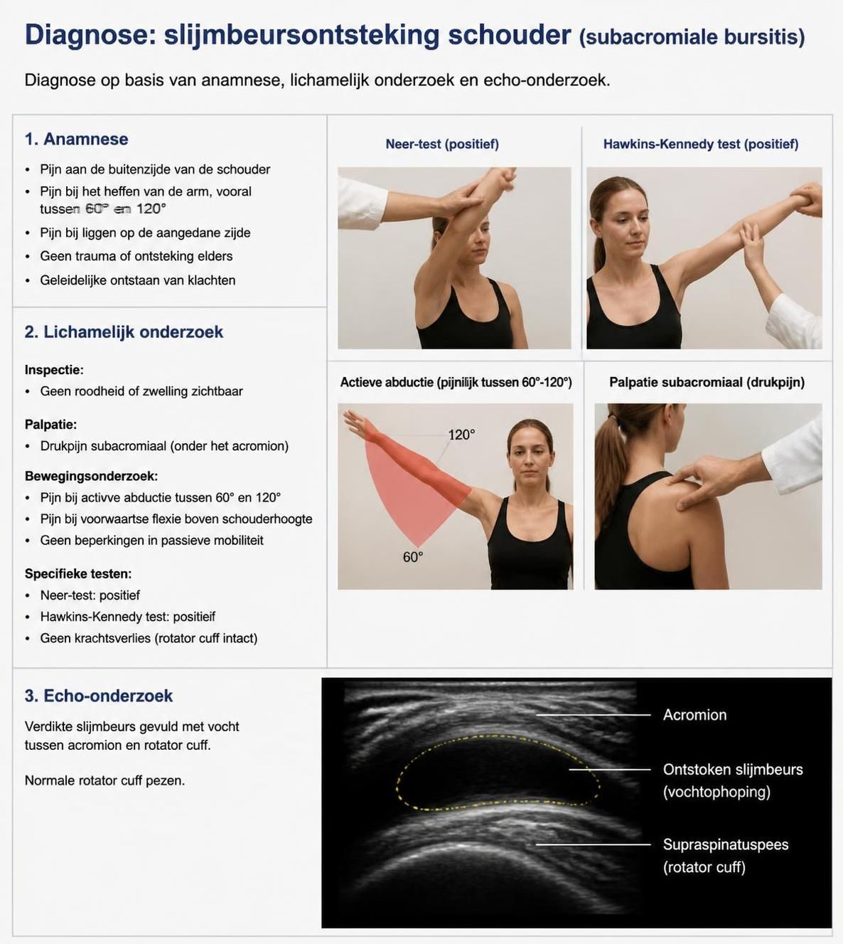 ontdek hoe je een slijmbeursontsteking in de schouder correct test met onze eenvoudige en effectieve gids voor een juiste diagnose.