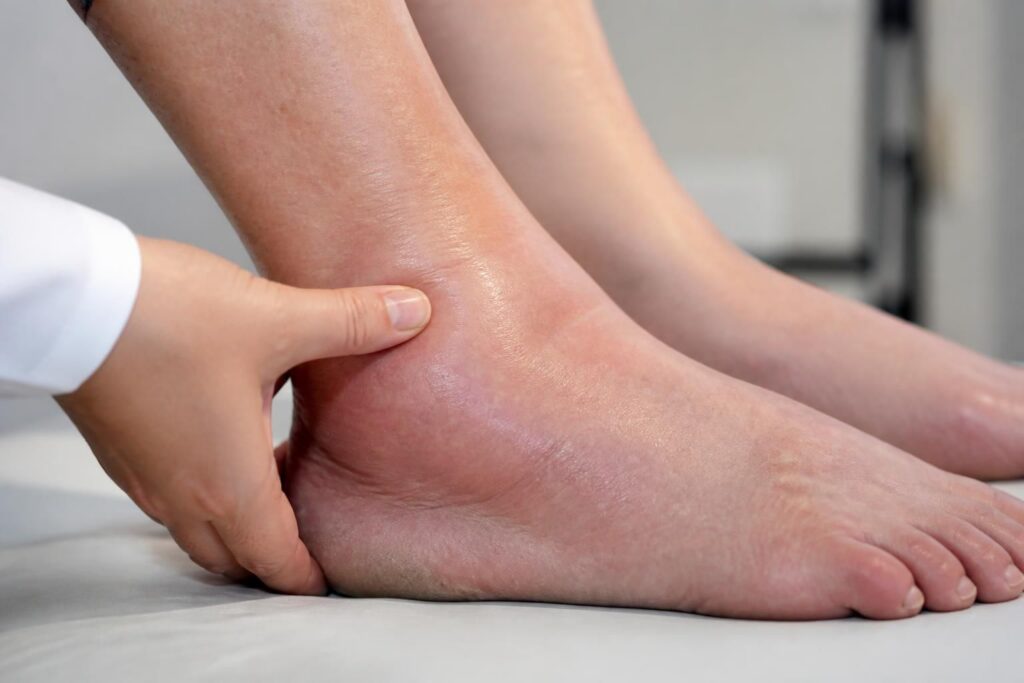 ontdek de meest voorkomende oorzaken van dikke enkels en leer hoe je deze kunt herkennen voor een betere gezondheid en verzorging.