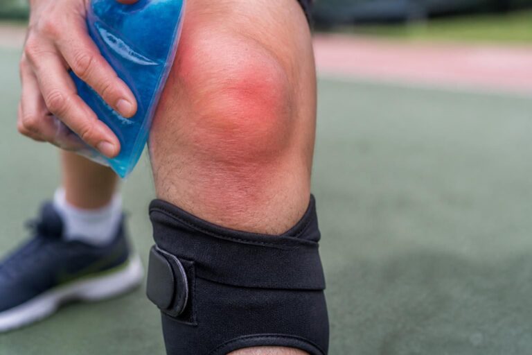 ontdek de symptomen, oorzaken en effectieve behandelingen van een overbelaste knie om sneller herstel en pijnvermindering te bevorderen.