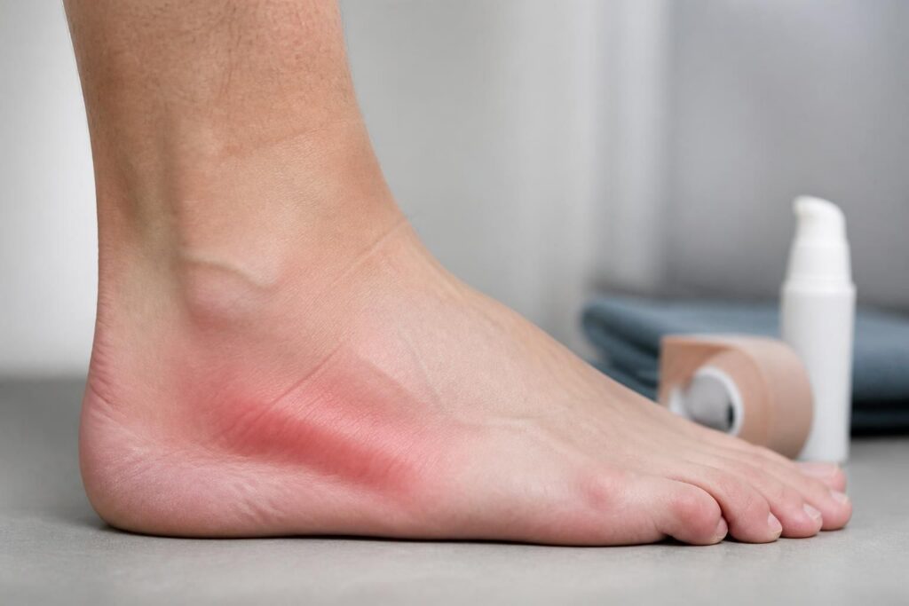 ontdek de oorzaken en effectieve behandelingen van peesontsteking aan de zijkant van de voet. leer hoe je pijn kunt verminderen en sneller kunt herstellen.