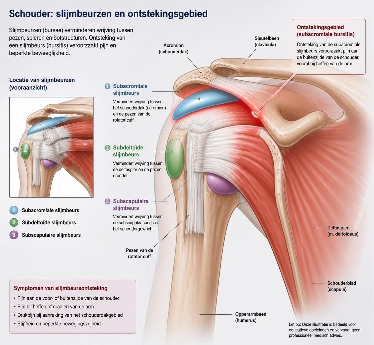 leer hoe u de symptomen van een schouder slijmbeursontsteking kunt herkennen en effectieve behandelingsmogelijkheden.